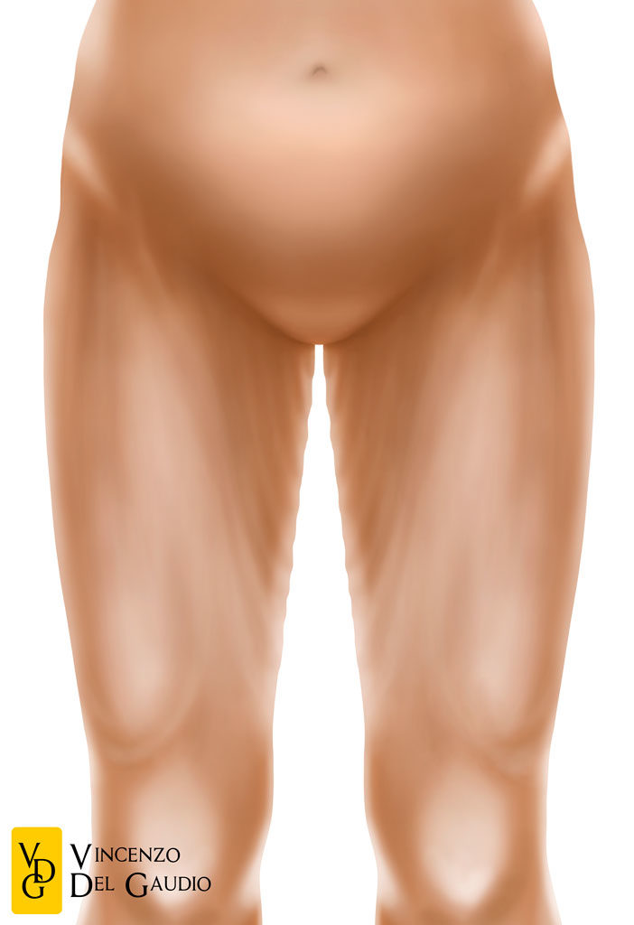 illustrazione lifting delle cosce 01
