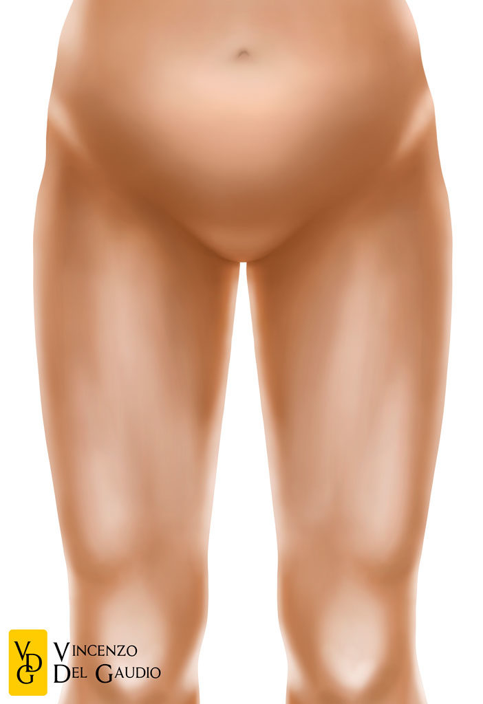 illustrazione lifting delle cosce 03