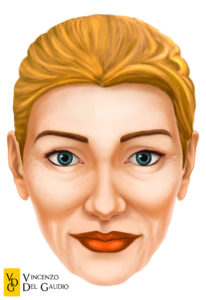 illustrazione lipofilling del volto 01