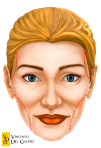 illustrazione lipofilling del volto 02