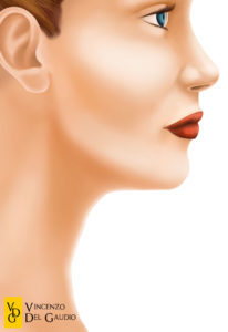 illustrazione mini-lifting 03