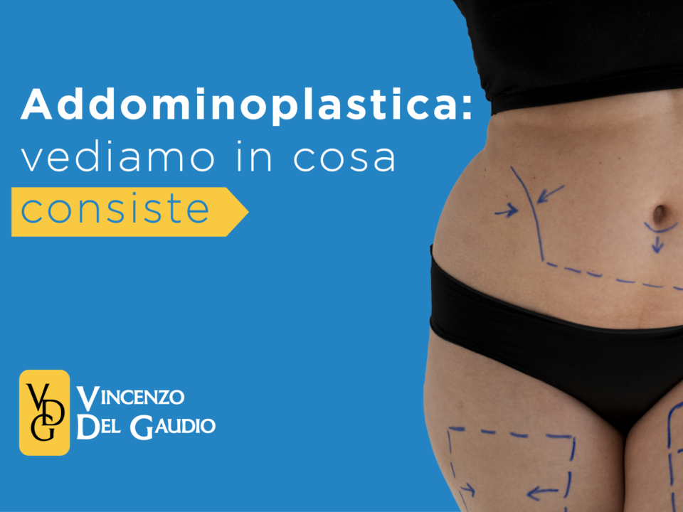 in che cosa consiste l'addominoplastica