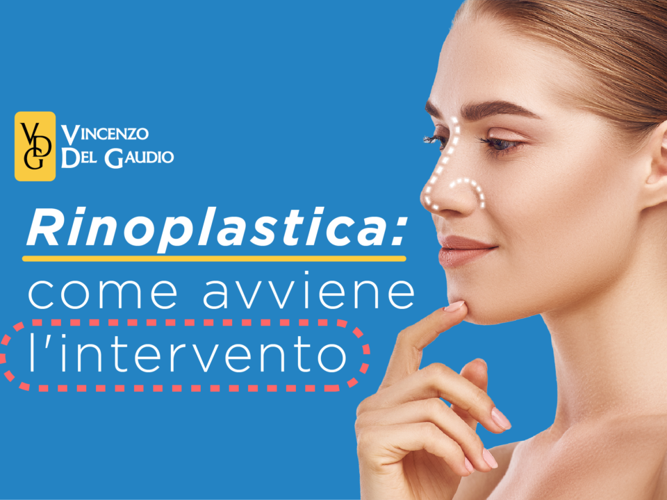 come funziona la rinoplastica al naso