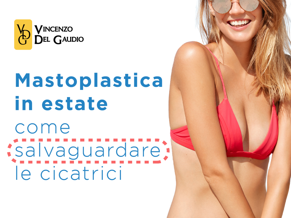 mastoplastica in estate