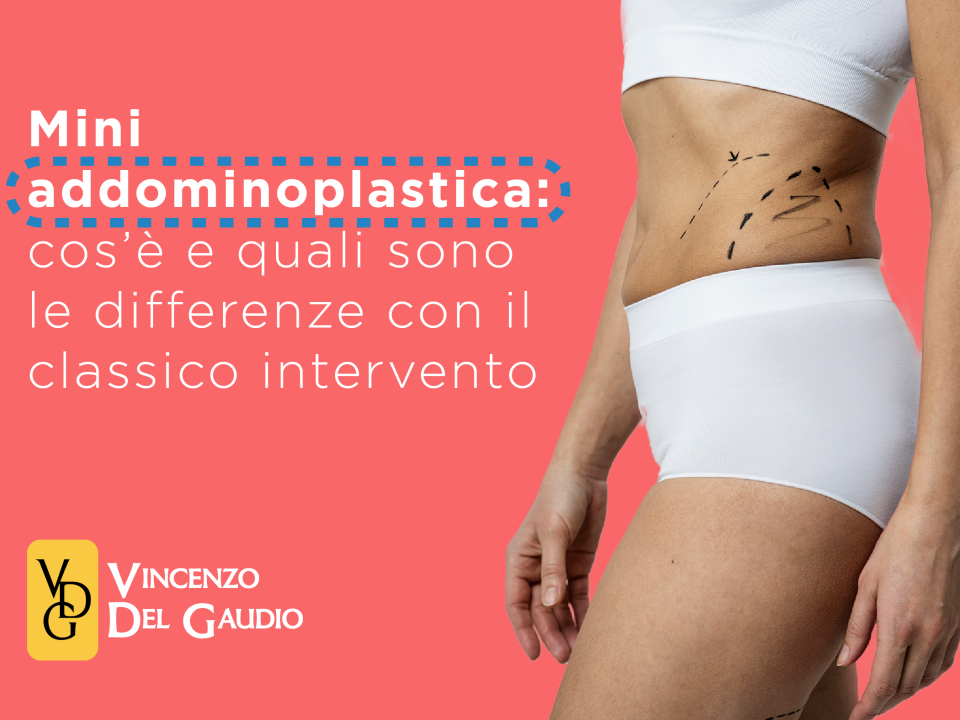 mini addominoplastica cos'è