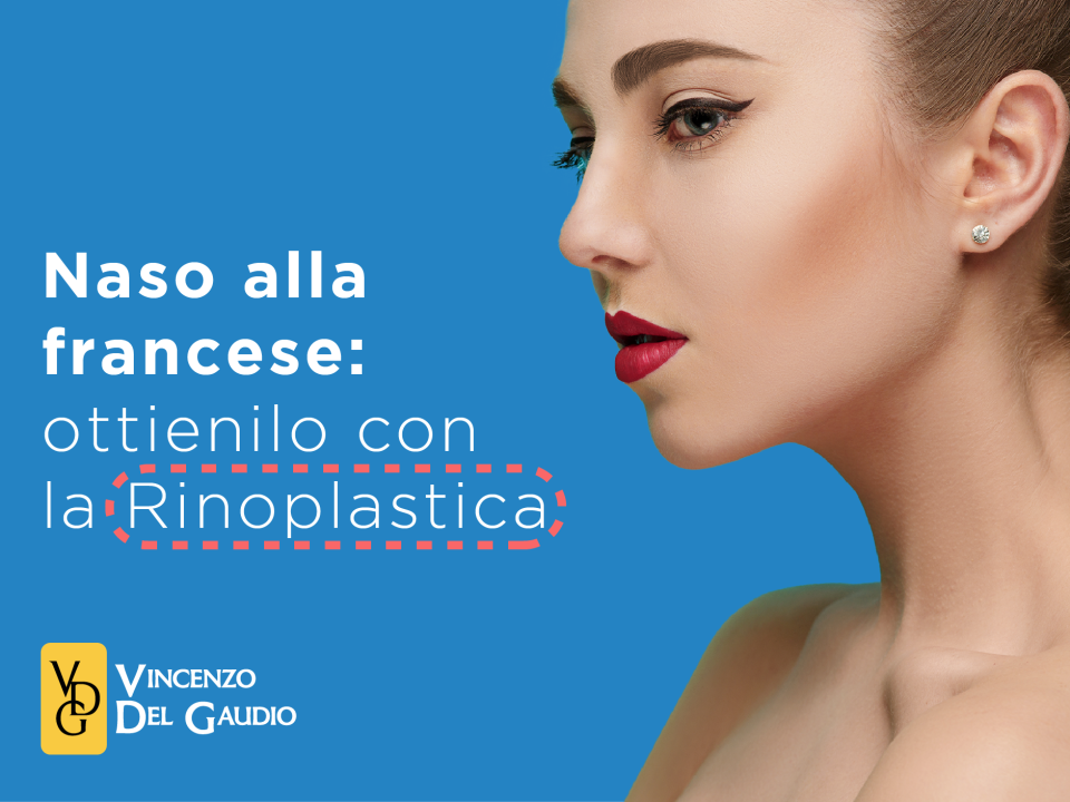 naso alla francese come ottenerlo con la rinoplastica