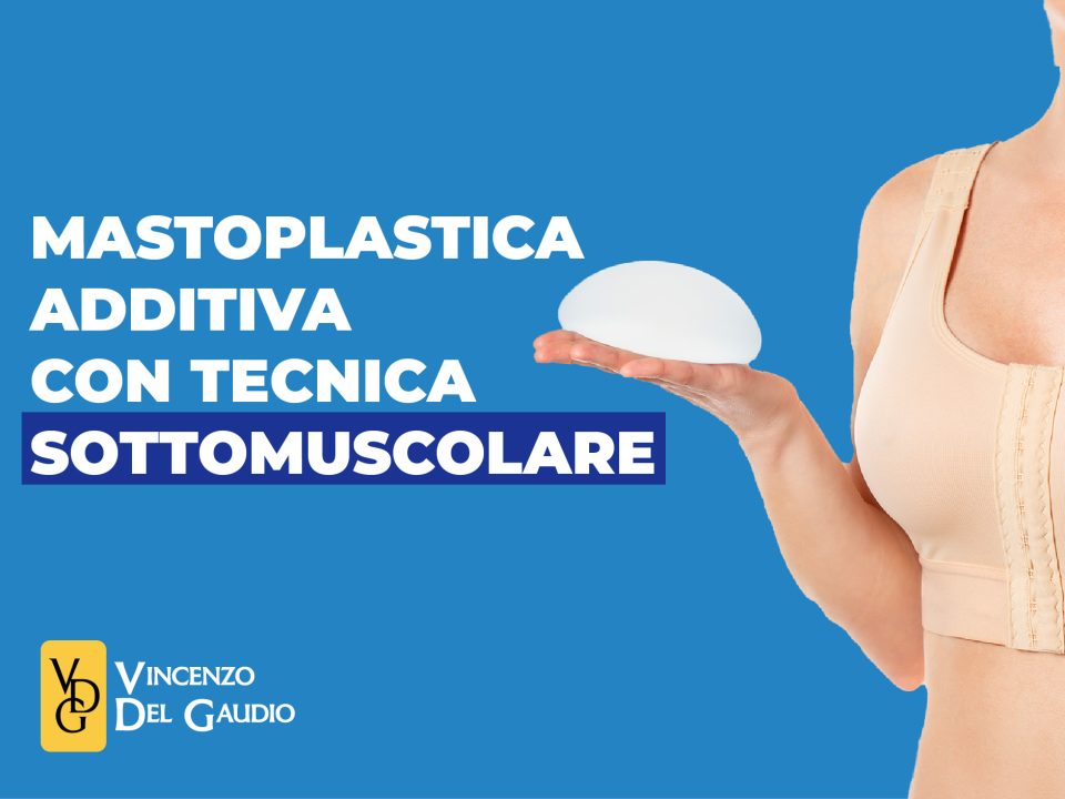 mastoplastica additiva sottomuscolo