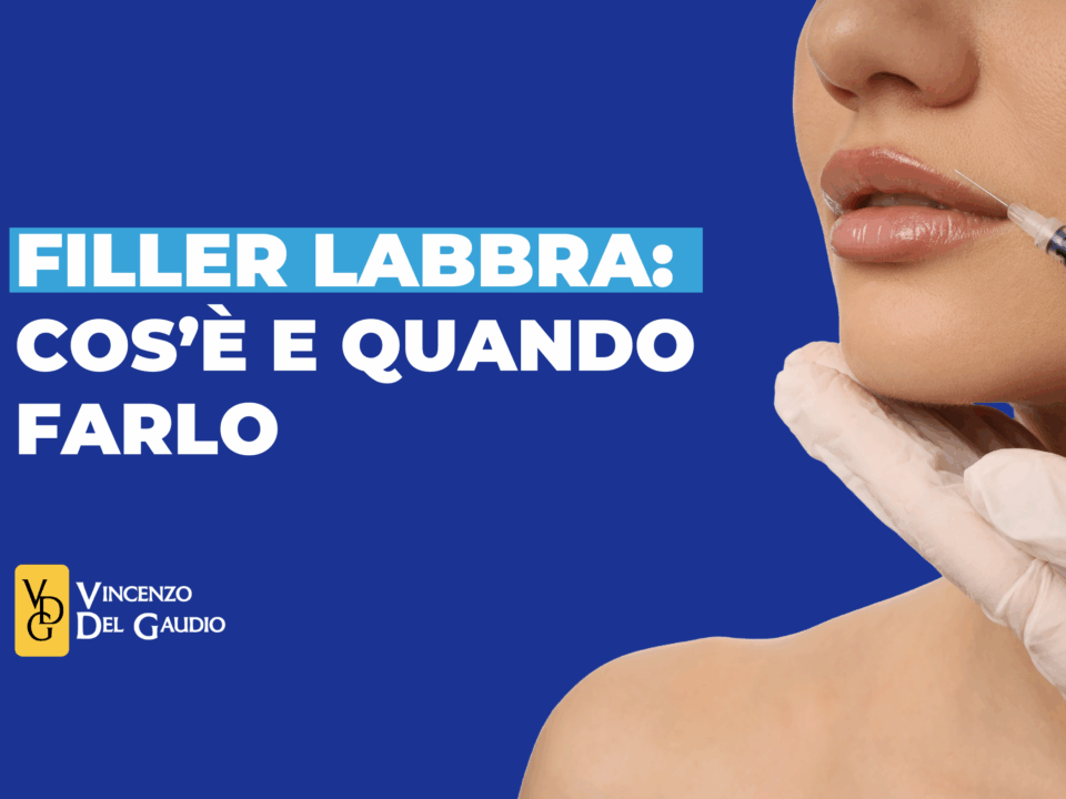 filler labbra cos'è e quando farlo