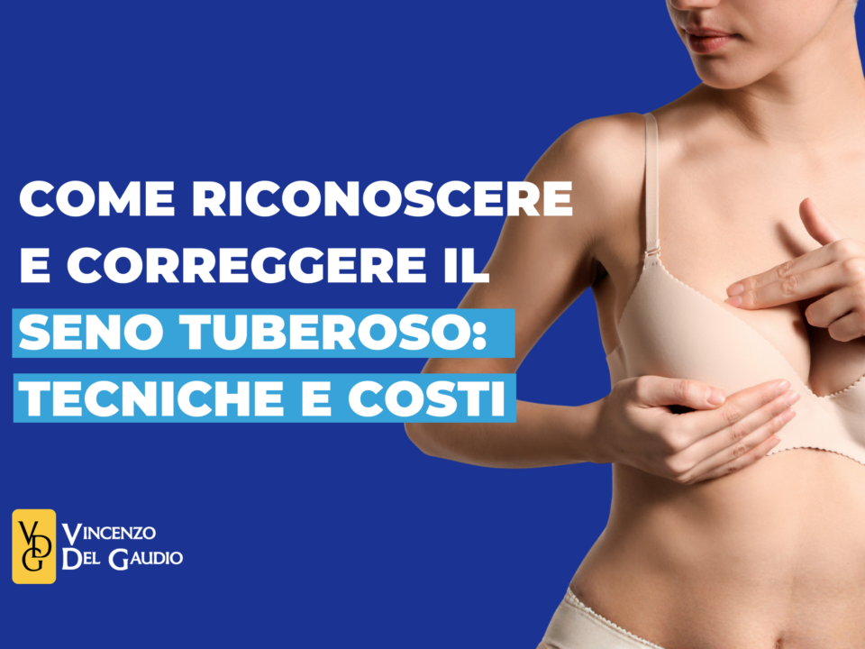 come riconoscere e correggere il seno tuberoso tecniche e costi