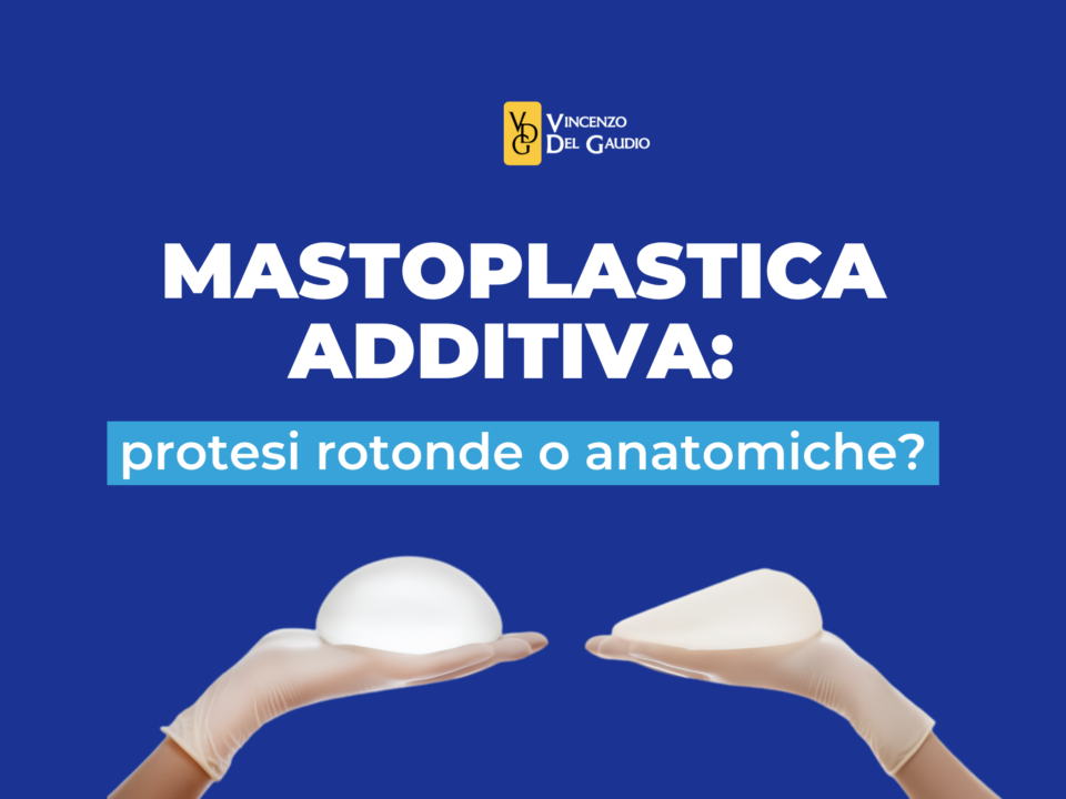protesi rotonde o anatomiche guida alla scelta