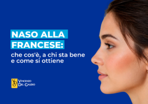 naso alla francese cose