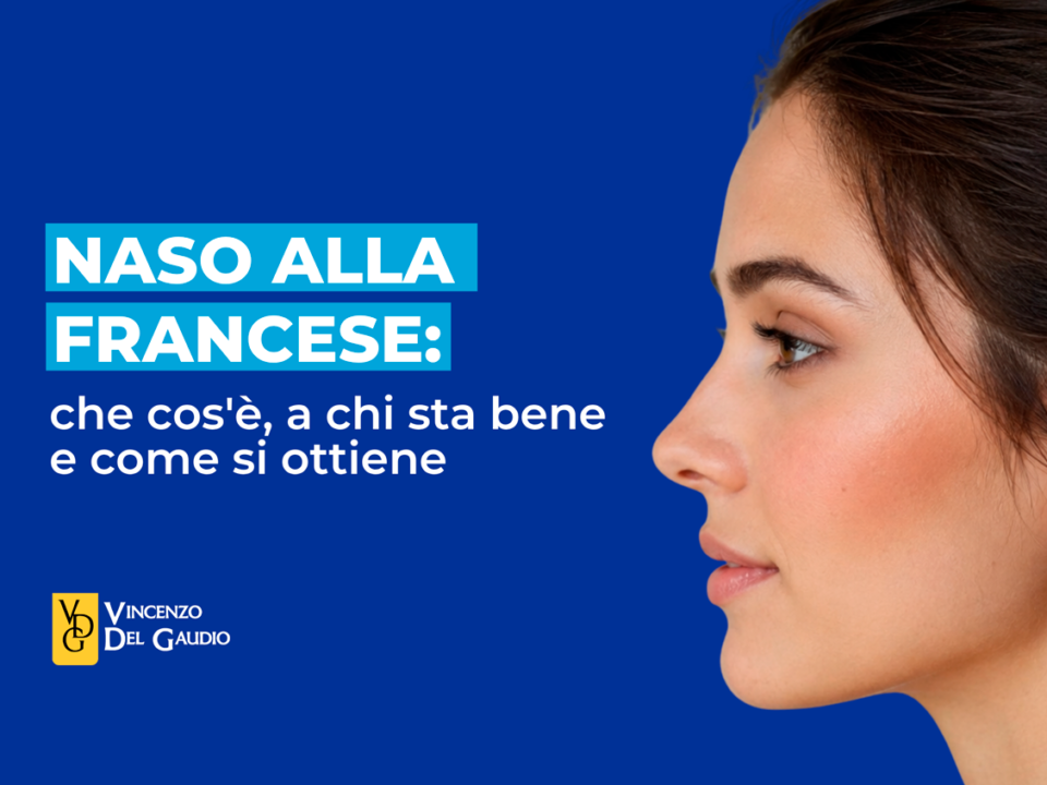 naso alla francese cose